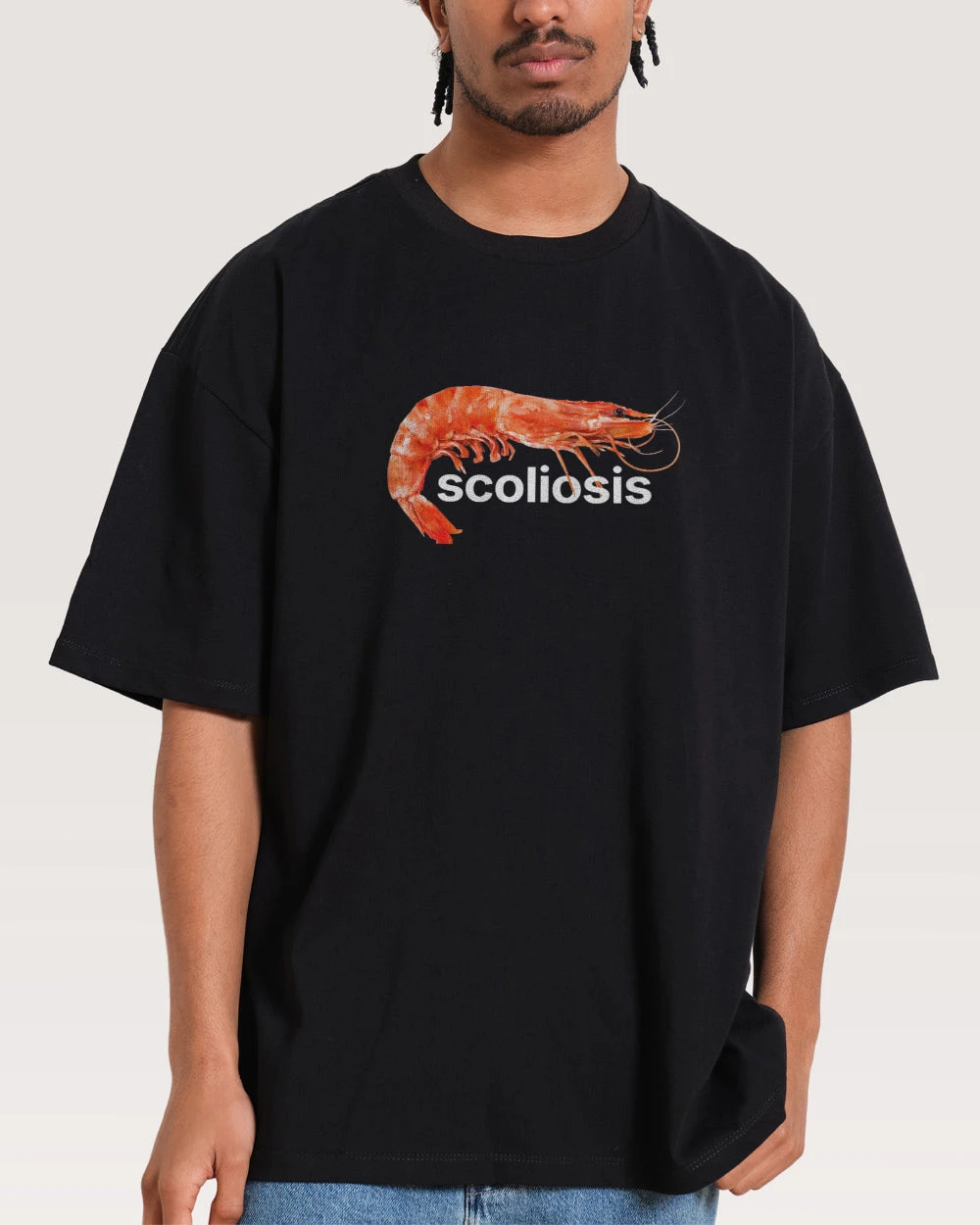Scoliosis Oversized Tee 3 Scoliosis Oversized Tee