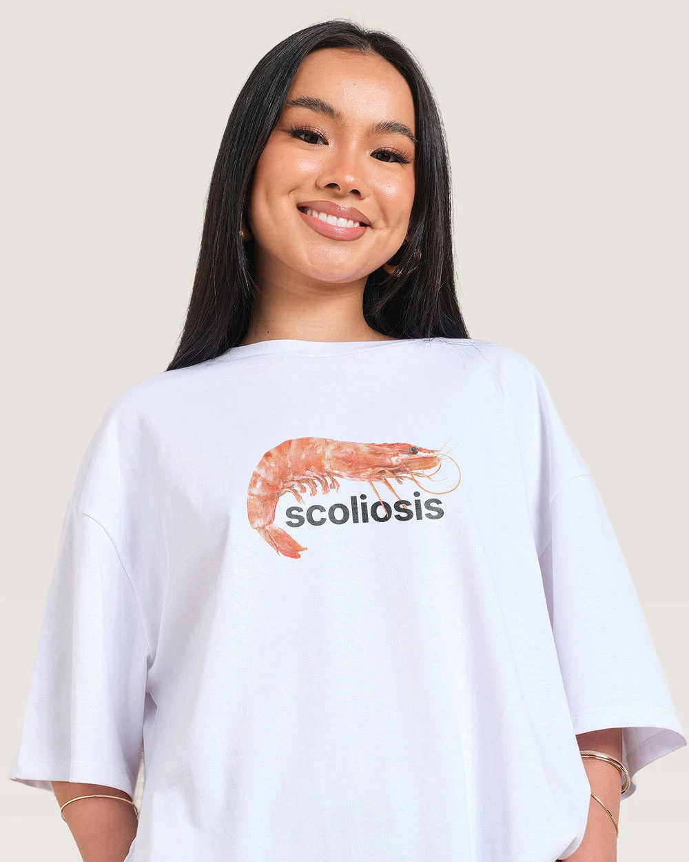 Scoliosis Oversized Tee 4 Scoliosis Oversized Tee - Image 2